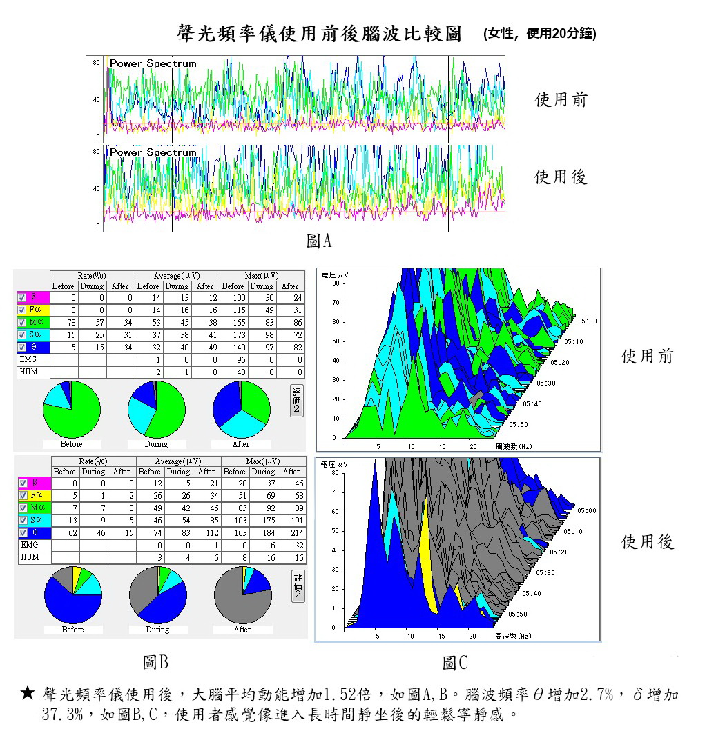 聲光頻率儀使用前後腦波比較圖 女性 使用二十分鐘